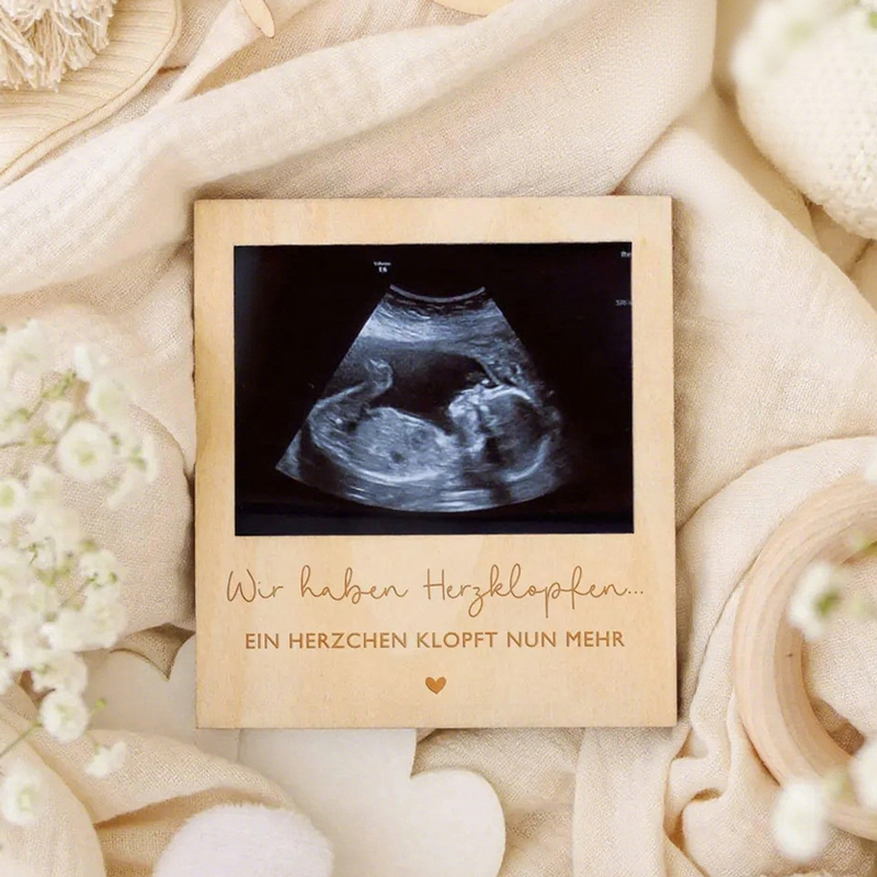Photo Frame Baby - Ultrasound Pregnancy Announcement Sign Wooden Photobooth