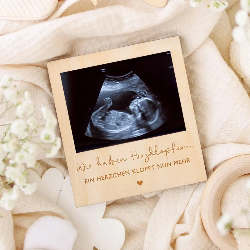 Ultrasound Pregnancy Announcem - Photo Frame Baby ulasan dan harga